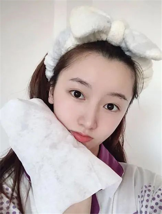 洗脸时做到这4点，坚持一段时间，痘痘黑头变少了  洗脸 皮肤 卸妆 第3张