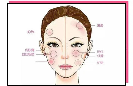皮肤不好,可能是经常熬夜,化妆不卸妆的问题,这5条你知道吗 面膜 皮肤 就会 第4张 皮肤不好,可能是经常熬夜,化妆不卸妆的问题,这5条你知道吗 面膜 皮肤 就会 第4张