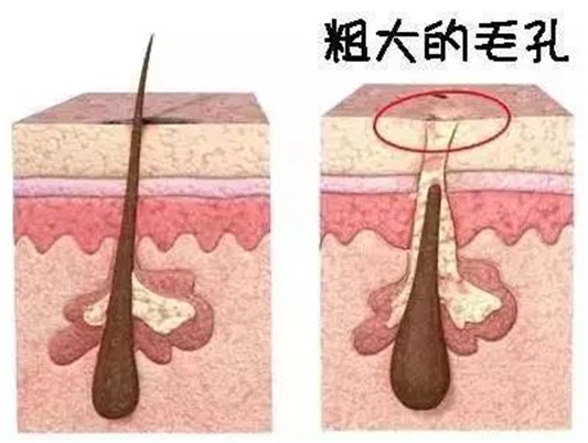 长期化妆对皮肤有什么危害可能毛孔粗大皮肤暗沉，这些都是后果  皮肤 明星 毛孔 第6张