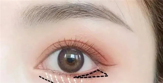 超自然卧蚕教学，眼睛一秒放大，想要桥本环奈电眼不是梦  眼睑 下至 阴影 第3张