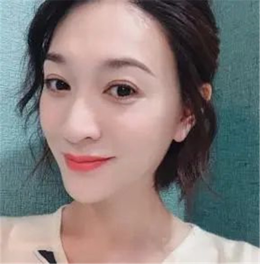 为什么女明星有「牛奶肌」她们晚上都会这么做，被很多人忽略了  皮肤 面膜 黑头 第2张
