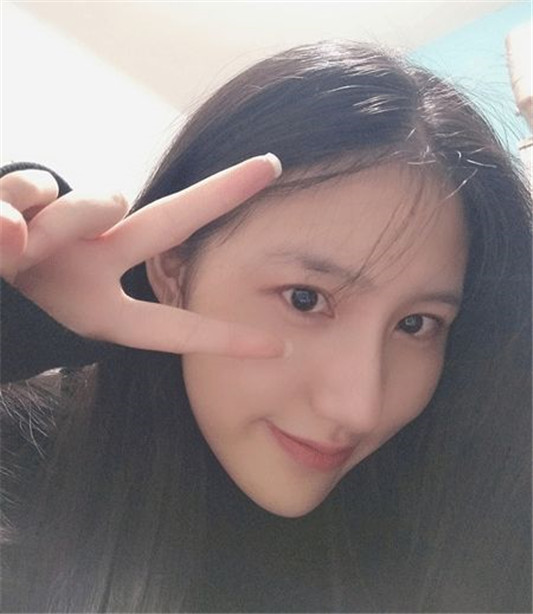 记录女生隆鼻术后88天的变化，过程虽痛苦，但结果很美丽  鼻子 术后 医生 第3张