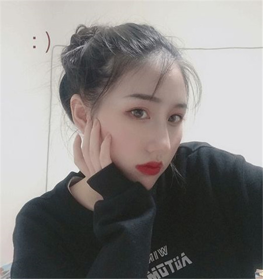 记录女生隆鼻术后88天的变化，过程虽痛苦，但结果很美丽  鼻子 术后 医生 第5张