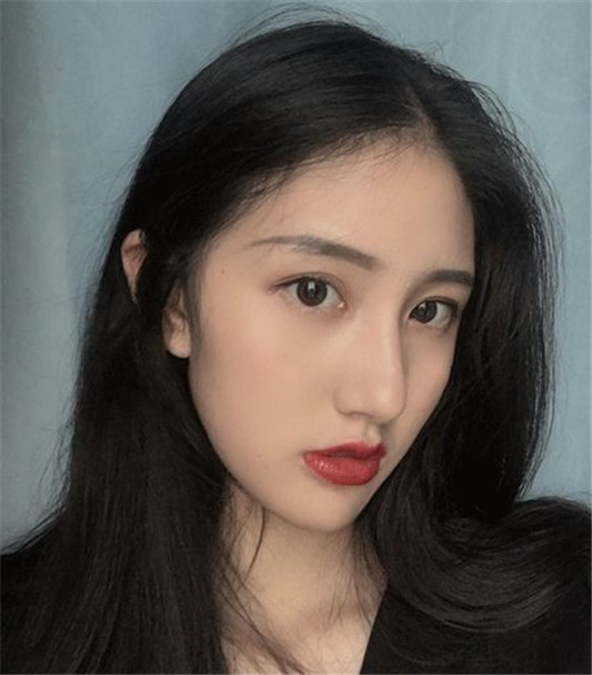 记录女生隆鼻术后88天的变化，过程虽痛苦，但结果很美丽  鼻子 术后 医生 第8张