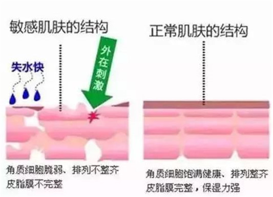 自己到底是什么肤质这篇文章统统告诉你  肌肤 干性 肤质 第2张