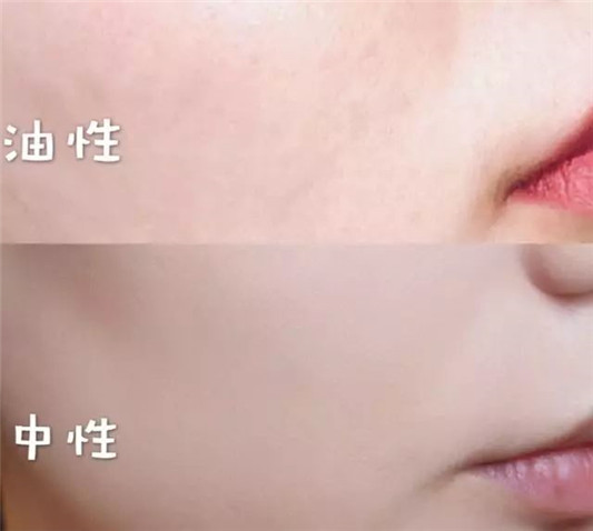 自己到底是什么肤质这篇文章统统告诉你  肌肤 干性 肤质 第11张