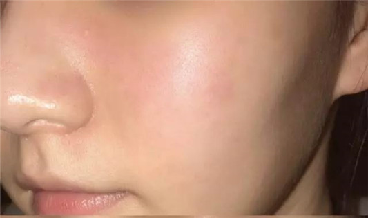 自己到底是什么肤质这篇文章统统告诉你  肌肤 干性 肤质 第12张