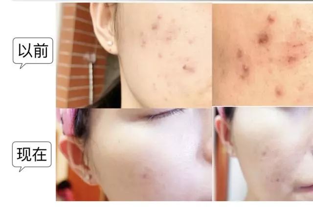 医美护肤品到底是何方神圣为什么用过都说好有效成分大揭秘  护肤品 皮肤 成分 第2张