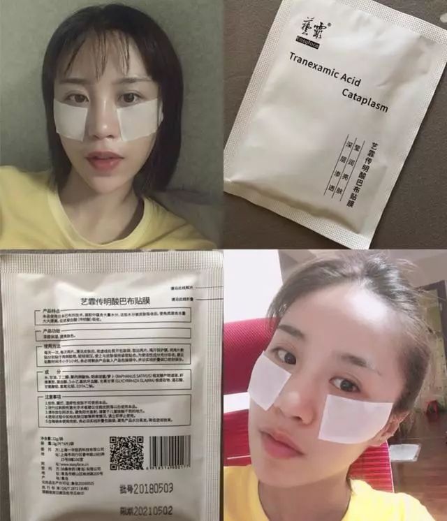 医美护肤品到底是何方神圣为什么用过都说好有效成分大揭秘  护肤品 皮肤 成分 第6张