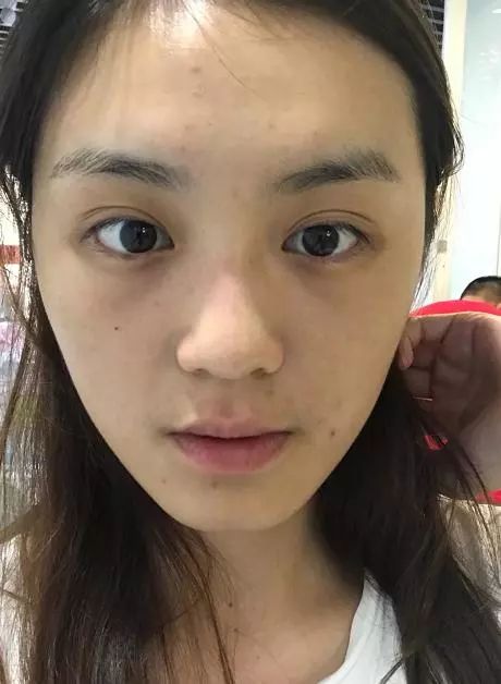 「坚持护肤」和「懒得护肤」的人，10年以后会怎样差别让人吃惊  护肤 皮肤 的人 第7张