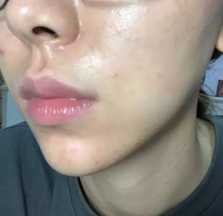 皮肤类型有5种，很多人都是前两种，最后一种是「耐老型」皮肤  皮肤 干性 护肤 第3张
