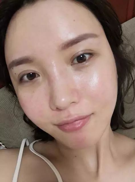 皮肤类型有5种，很多人都是前两种，最后一种是「耐老型」皮肤  皮肤 干性 护肤 第4张