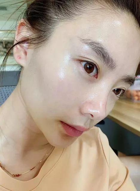 皮肤类型有5种，很多人都是前两种，最后一种是「耐老型」皮肤  皮肤 干性 护肤 第11张