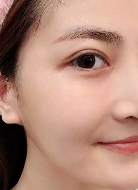 皮肤类型有5种，很多人都是前两种，最后一种是「耐老型」皮肤  皮肤 干性 护肤 第12张