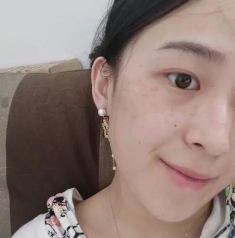 护肤重点只知道补水和美白别忘了防晒，做不好老的很快  防晒 防晒霜 皮肤 第5张