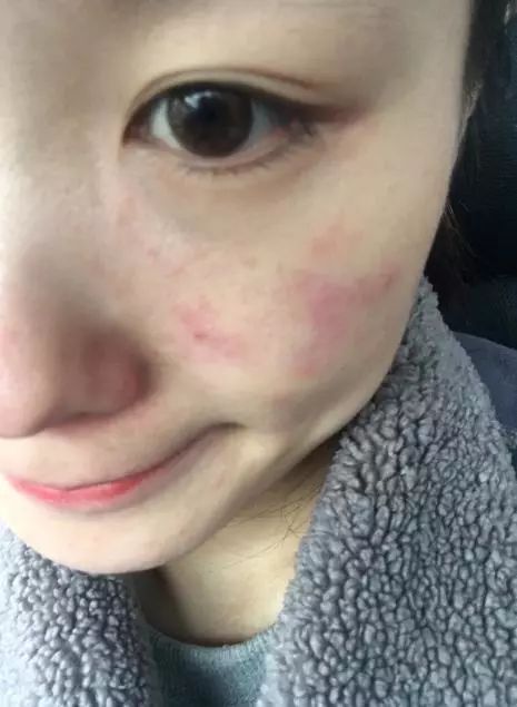 护肤重点只知道补水和美白别忘了防晒，做不好老的很快  防晒 防晒霜 皮肤 第7张