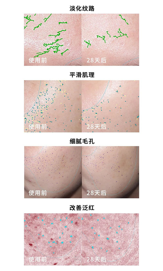 科颜氏最新皇牌爆款精华，一支解决8大肌肤问题  肌肤 尿酸 精华 第3张