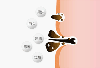 一口气挤出所有陈年黑头，实在是太太太太爽了  毛孔 肌肤 清洁 第3张