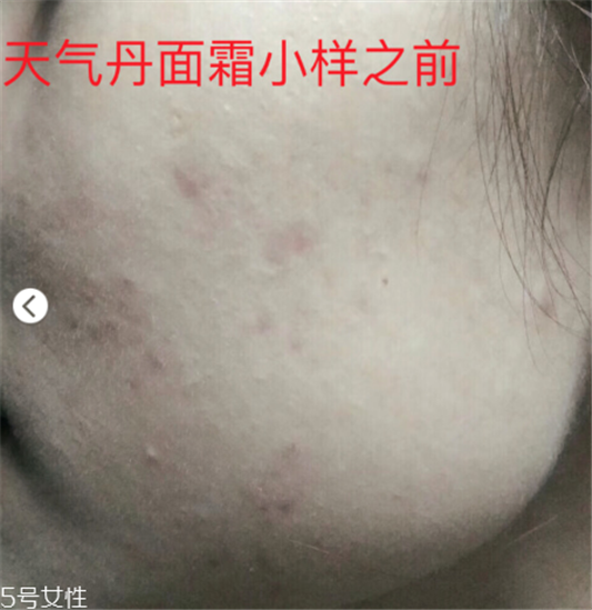 whoo后的天气丹效果怎么样 敏感肌也可以放心使用  whoo 后 whoo后 第3张