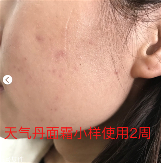 whoo后的天气丹效果怎么样 敏感肌也可以放心使用  whoo 后 whoo后 第4张
