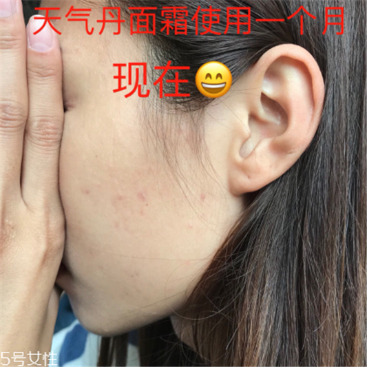 whoo后的天气丹效果怎么样 敏感肌也可以放心使用  whoo 后 whoo后 第5张