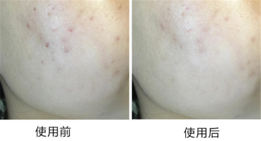 雪花秀润燥精华夏天用油吗 雪花秀润燥精华适合夏天吗  雪花秀 精华 第2张