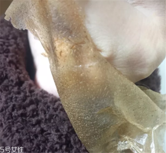 雪花秀撕拉面膜怎么撕出黑头，这么做才能去黑头  雪花秀 撕拉面膜 第3张