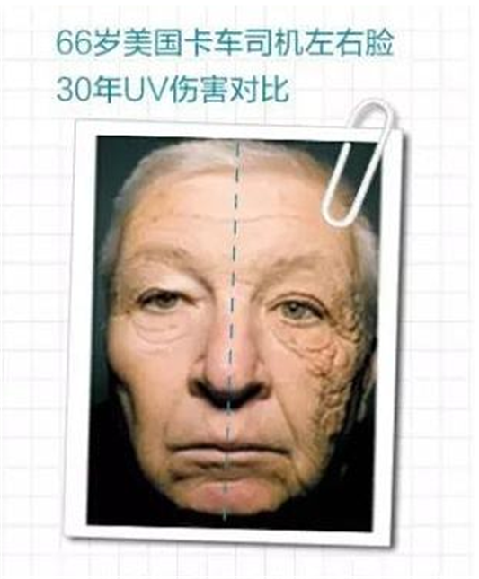 不涂防晒霜的危害，不涂防晒霜的后果图片对比