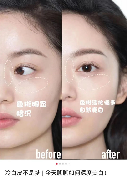 倩碧镭**华抑制黑色素，美白淡斑  倩碧镭**华 第5张
