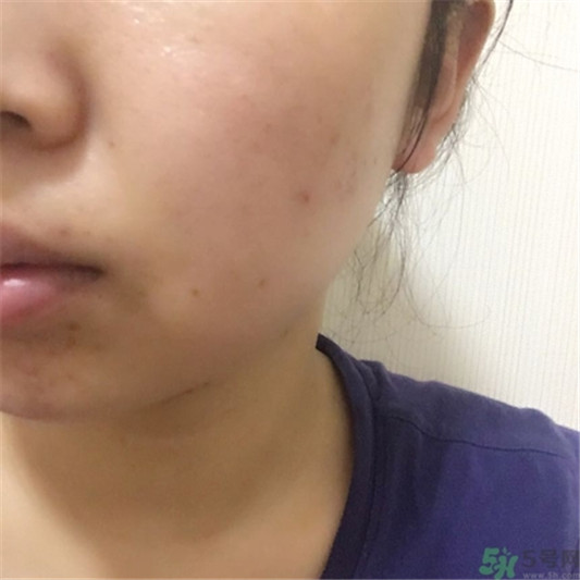 sum37泡泡面膜用完要洗脸吗,sum37泡泡面膜的功效与作用 sum37 面膜 呼吸37度 第17张 sum37泡泡面膜用完要洗脸吗,sum37泡泡面膜的功效与作用 sum37 面膜 呼吸37度 第17张