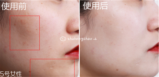 兰芝小白光气垫bb霜使用方法,水光透白的自然妆感 兰芝 气垫 呼吸37度 第10张 兰芝小白光气垫bb霜使用方法,水光透白的自然妆感 兰芝 气垫 呼吸37度 第10张