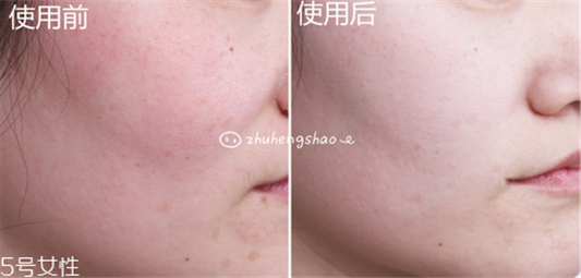 兰芝小白光气垫bb霜使用方法,水光透白的自然妆感 兰芝 气垫 呼吸37度 第11张 兰芝小白光气垫bb霜使用方法,水光透白的自然妆感 兰芝 气垫 呼吸37度 第11张