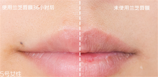 兰芝唇膜吃进去怎么办，拥有水嫩嘴唇  兰芝 唇膜 嘴唇 呼吸37度 第5张