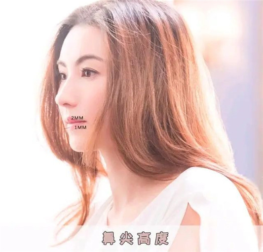 好看鼻子的七个标准，增添颜值还有辨识度，看你中了几条  鼻子 小柱 夹角 第7张