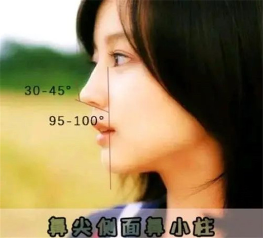 好看鼻子的七个标准，增添颜值还有辨识度，看你中了几条  鼻子 小柱 夹角 第8张