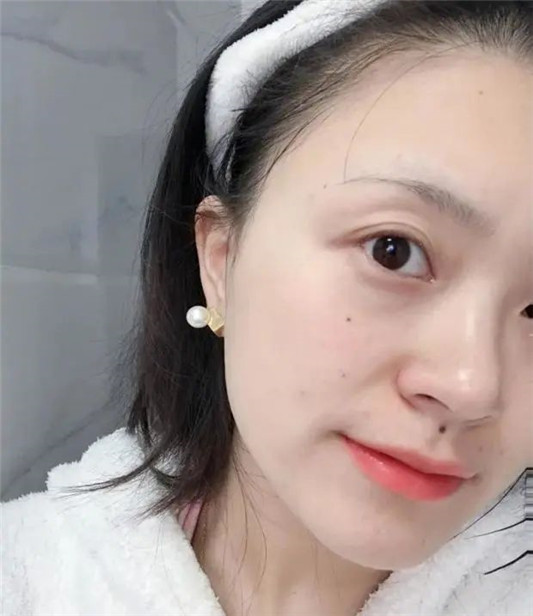 抗老精华你知道啥娇韵诗祛黄，资生堂红腰子修复，赫莲娜抗氧化  自己的 精华 肌肤 第7张