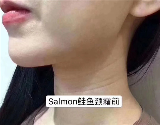 日本Salmon鲑鱼颈霜淡纹嫩白，塑造天鹅颈  日本 鲑鱼 颈霜 第4张