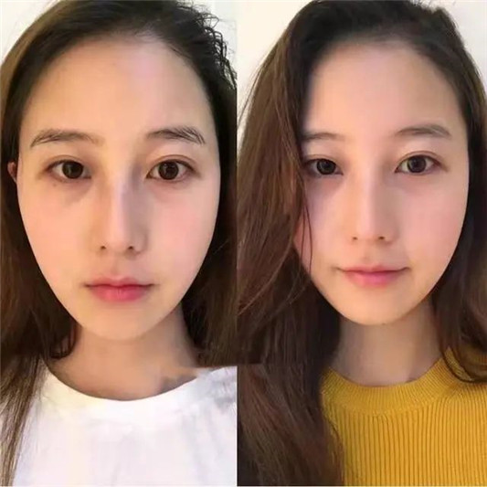 张韶涵的「少女大眼」养成记，如何拥有一双不会老的眼睛  大眼 少女 养成 第6张