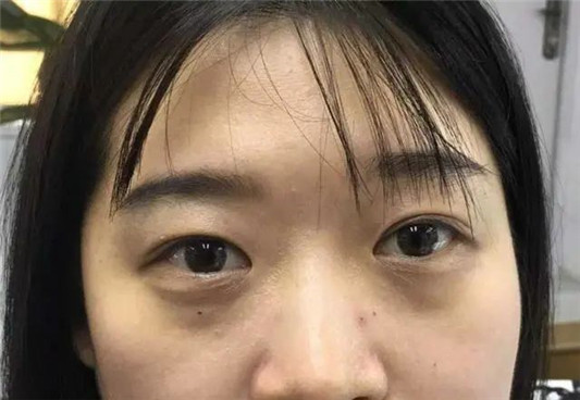 张韶涵的「少女大眼」养成记，如何拥有一双不会老的眼睛  大眼 少女 养成 第7张