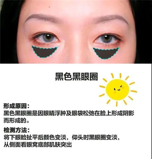 黑眼圈很影响美观，想告别黑眼圈最好用的方法  黑眼圈 好用 最好用 第4张