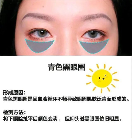 黑眼圈很影响美观，想告别黑眼圈最好用的方法  黑眼圈 好用 最好用 第9张