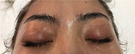 敏感混合性肌肤用什么