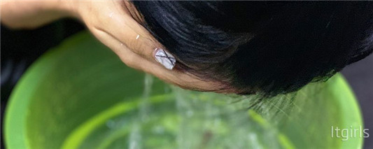 皮肤过敏的原因是什么，教你几招远离敏感肌  2020 皮肤 过敏 第3张