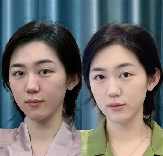 夏天为什么要「淡妆」这五点让你看透「女生」，到底漂亮还是丑  2020 夏天 皮肤 第5张