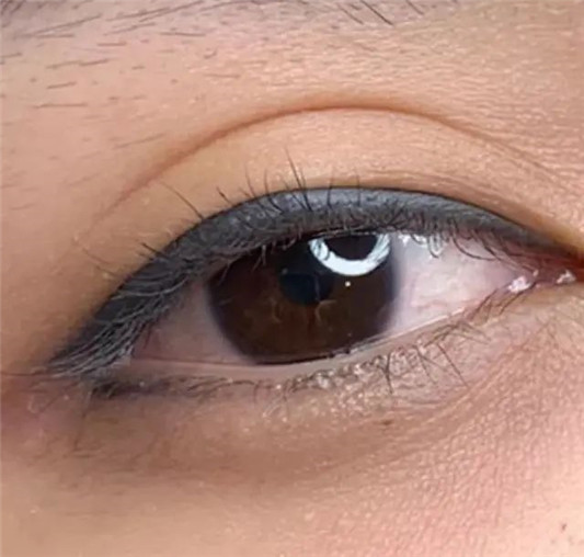 建议年轻女生不要纹「美瞳线」，不仅显老还有风险