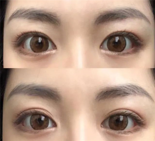 女人最好不要用这「3样」东西，皮肤松弛还可能拉低颜值