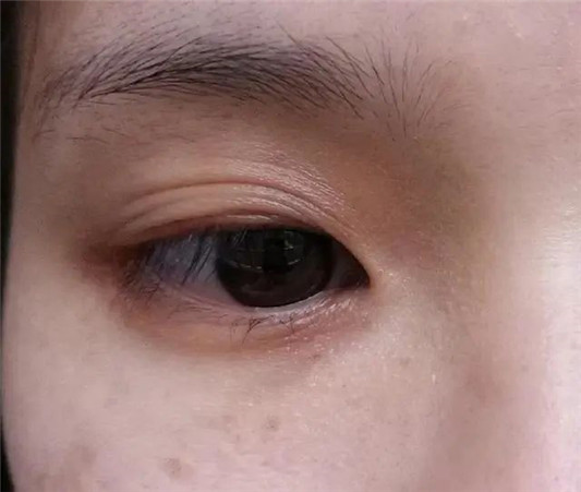 女人最好不要用这「3样」东西，皮肤松弛还可能拉低颜值  2020 眼皮 双眼 第3张