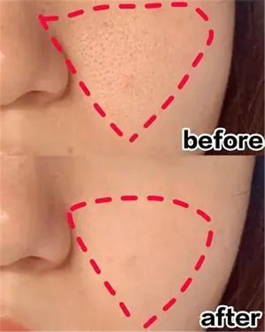 70多年历史的老牌国货「珍珠养肤」专家,功效全面性价比高 2020 珍珠粉 皮肤 第17张 70多年历史的老牌国货「珍珠养肤」专家,功效全面性价比高 2020 珍珠粉 皮肤 第17张