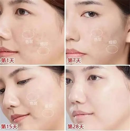 70多年历史的老牌国货「珍珠养肤」专家,功效全面性价比高 2020 珍珠粉 皮肤 第18张 70多年历史的老牌国货「珍珠养肤」专家,功效全面性价比高 2020 珍珠粉 皮肤 第18张