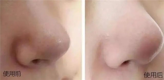 氨基酸洗面奶只认芙丽芳丝那你就out了,永芳这款性价比更高 2020 氨基酸 洗面 第12张 氨基酸洗面奶只认芙丽芳丝那你就out了,永芳这款性价比更高 2020 氨基酸 洗面 第12张